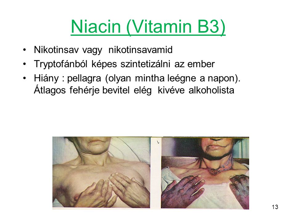 Niacin (Vitamin B3) Nikotinsav vagy nikotinsavamid