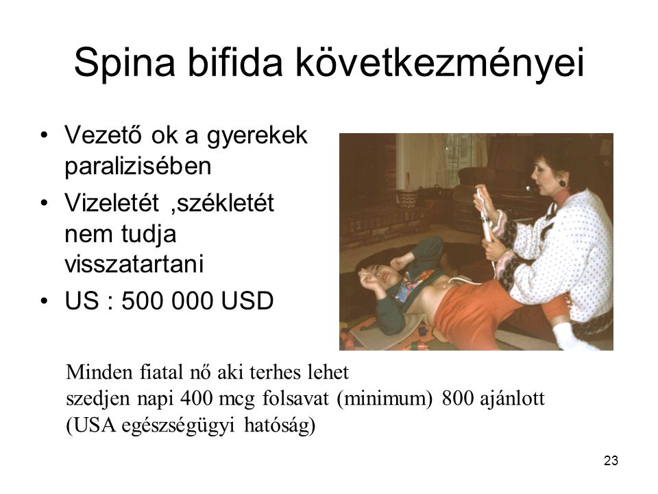 Spina bifida következményei