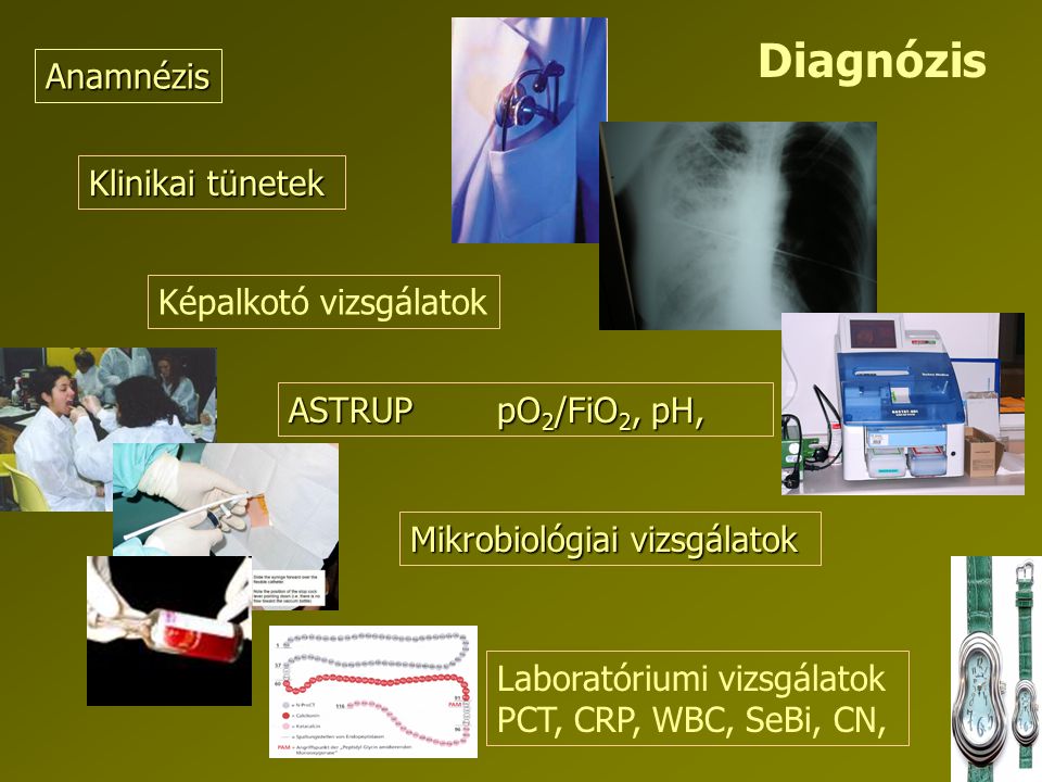 Diagnózis Anamnézis Klinikai tünetek Képalkotó vizsgálatok