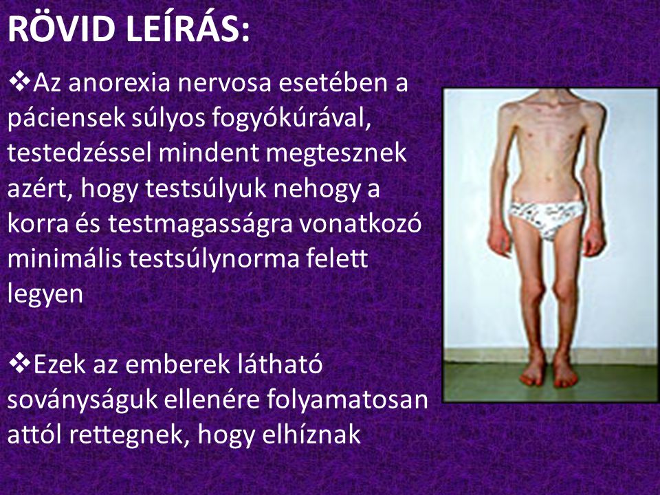 RÖVID LEÍRÁS: Az anorexia nervosa esetében a
