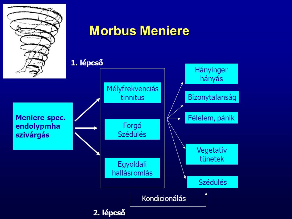 Morbus Meniere 1. lépcső Hányinger hányás Mélyfrekvenciás tinnitus