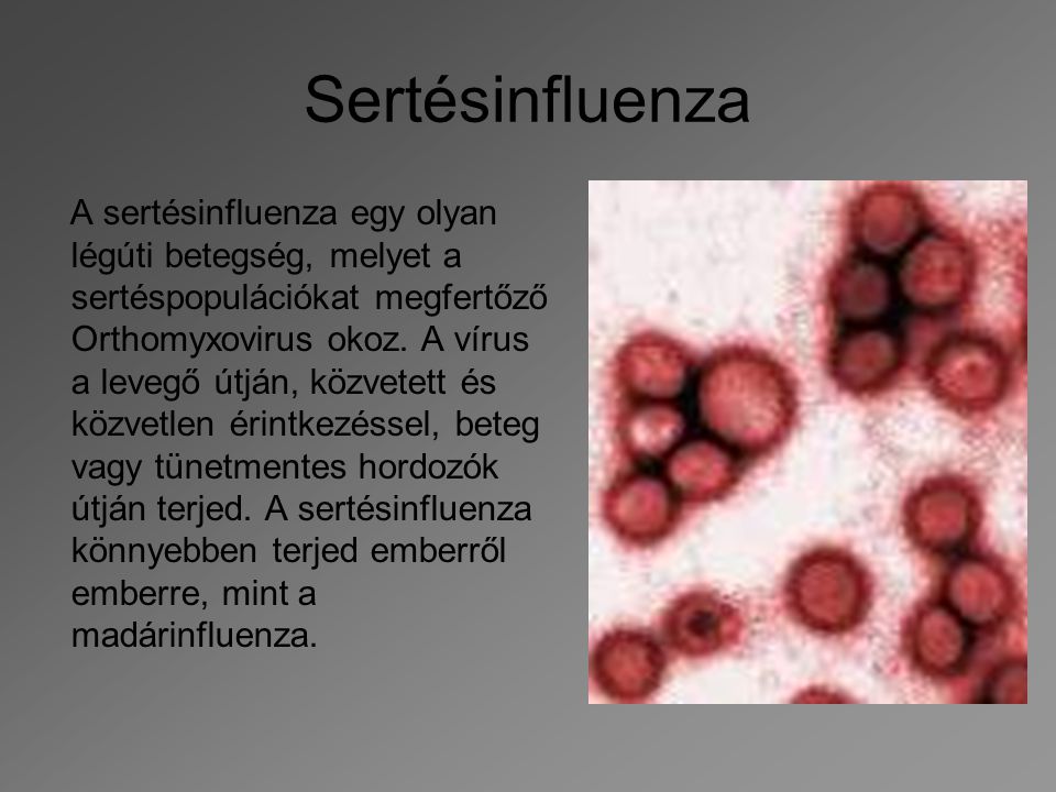 Sertésinfluenza