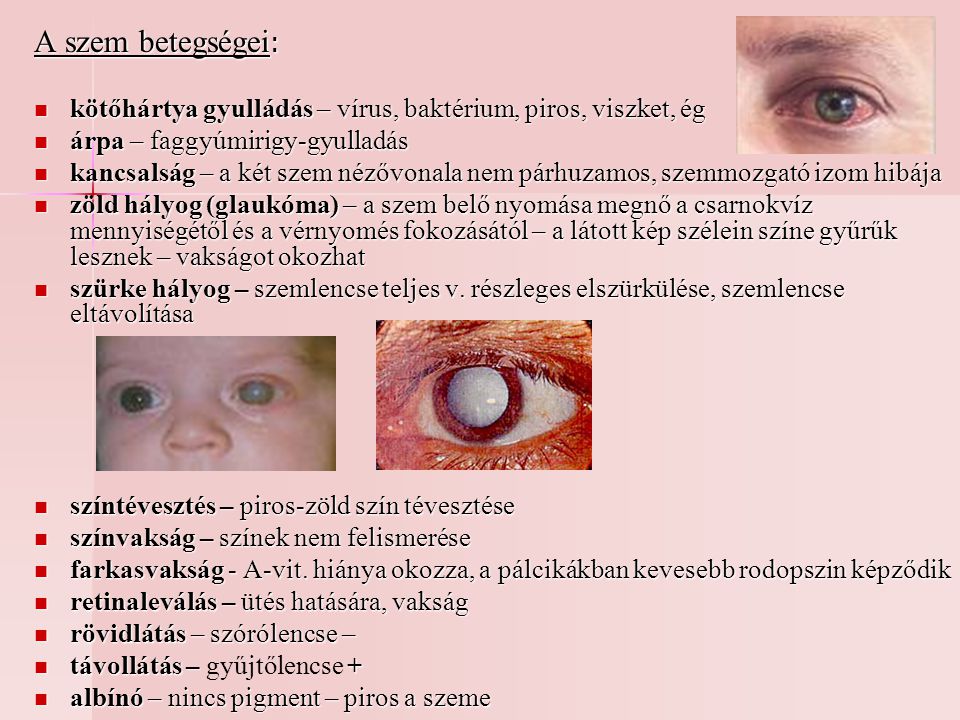 A szem betegségei: kötőhártya gyulládás – vírus, baktérium, piros, viszket, ég. árpa – faggyúmirigy-gyulladás.