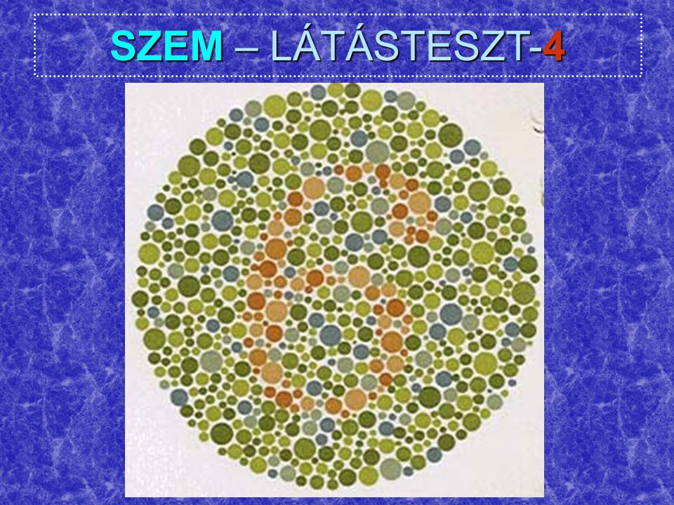 SZEM – LÁTÁSTESZT-4