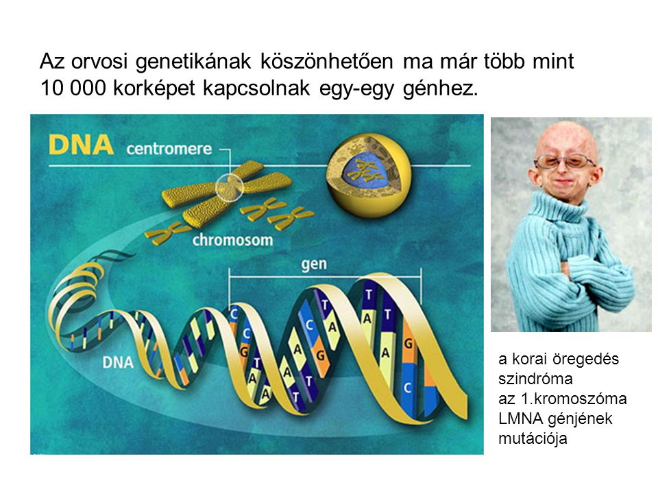 Az orvosi genetikának köszönhetően ma már több mint korképet kapcsolnak egy-egy génhez.