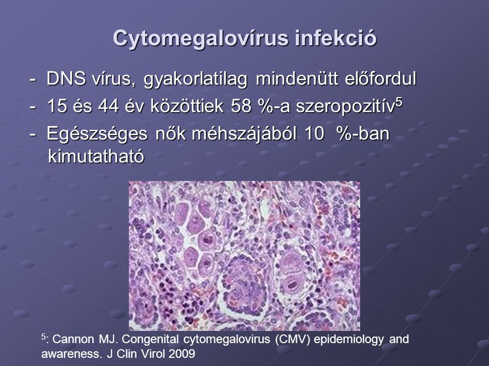 Cytomegalovírus infekció