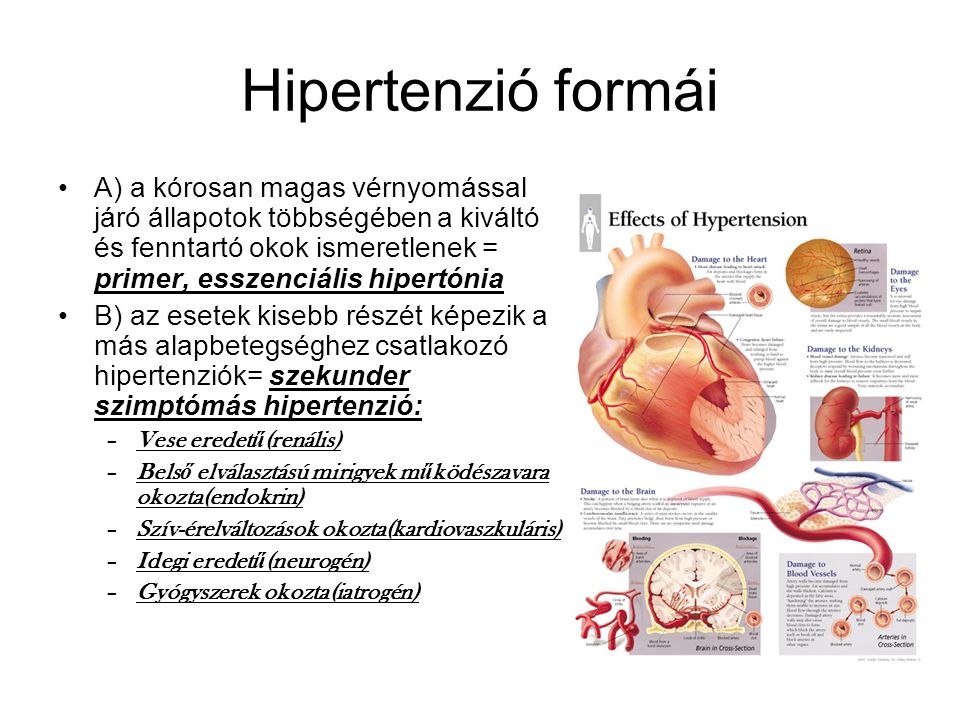 Hipertenzió formái