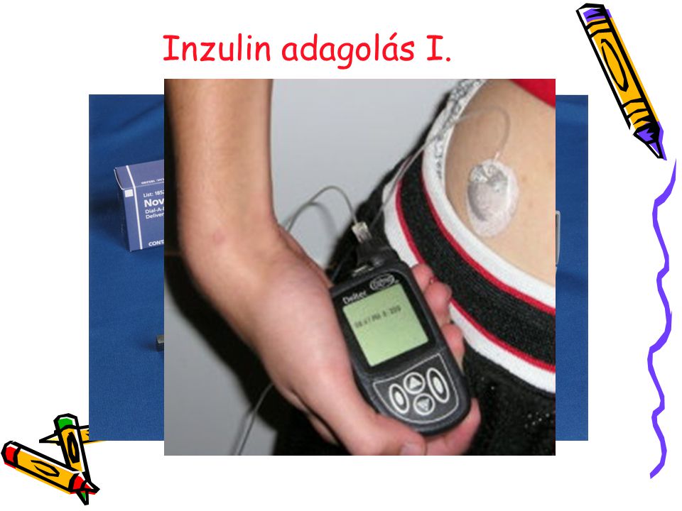 Inzulin adagolás I. 18
