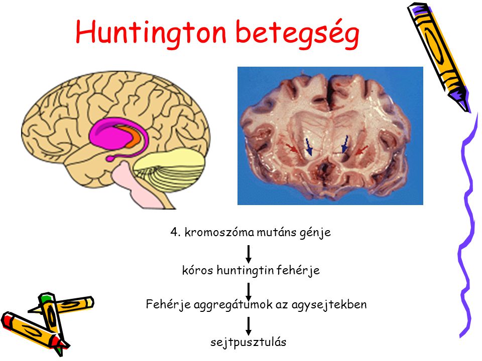 Huntington betegség 4. kromoszóma mutáns génje