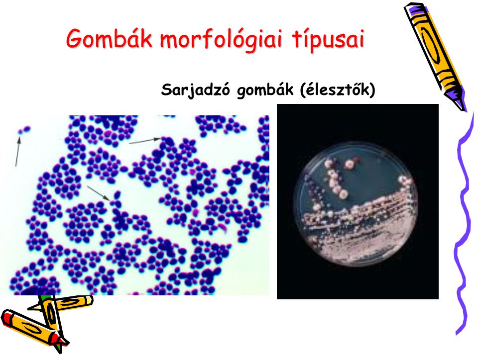 Gombák morfológiai típusai