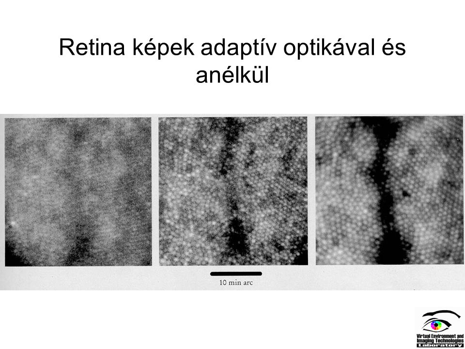 Retina képek adaptív optikával és anélkül