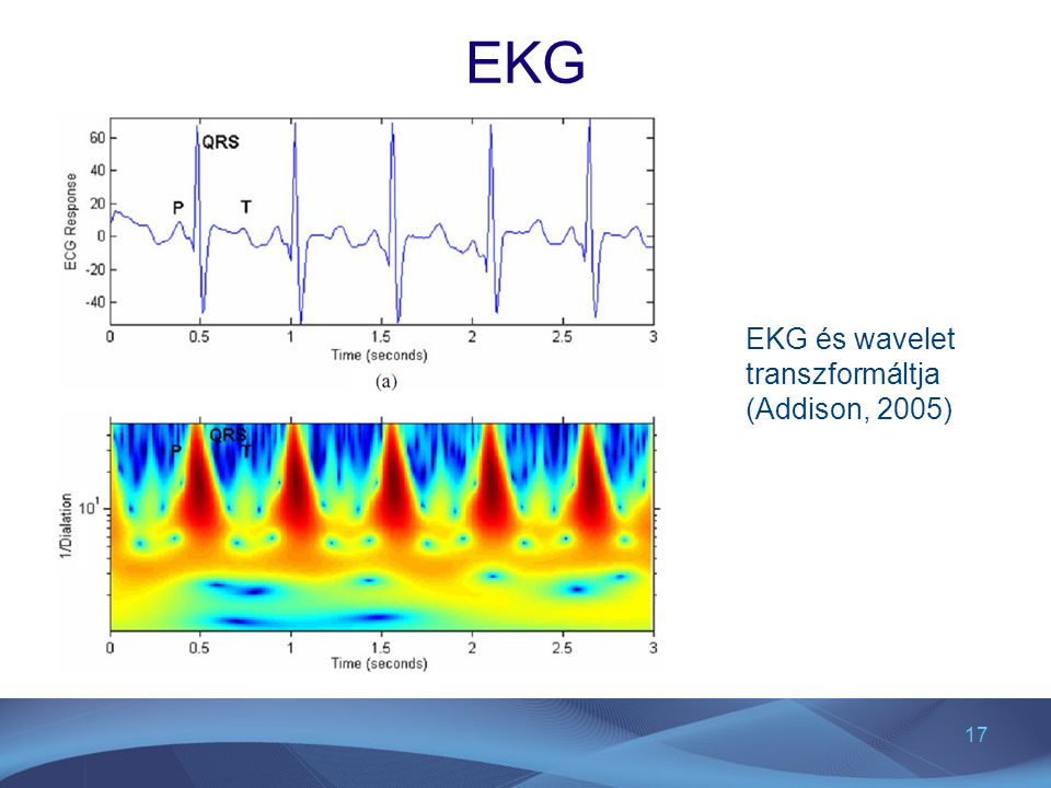 EKG EKG és wavelet transzformáltja (Addison, 2005)
