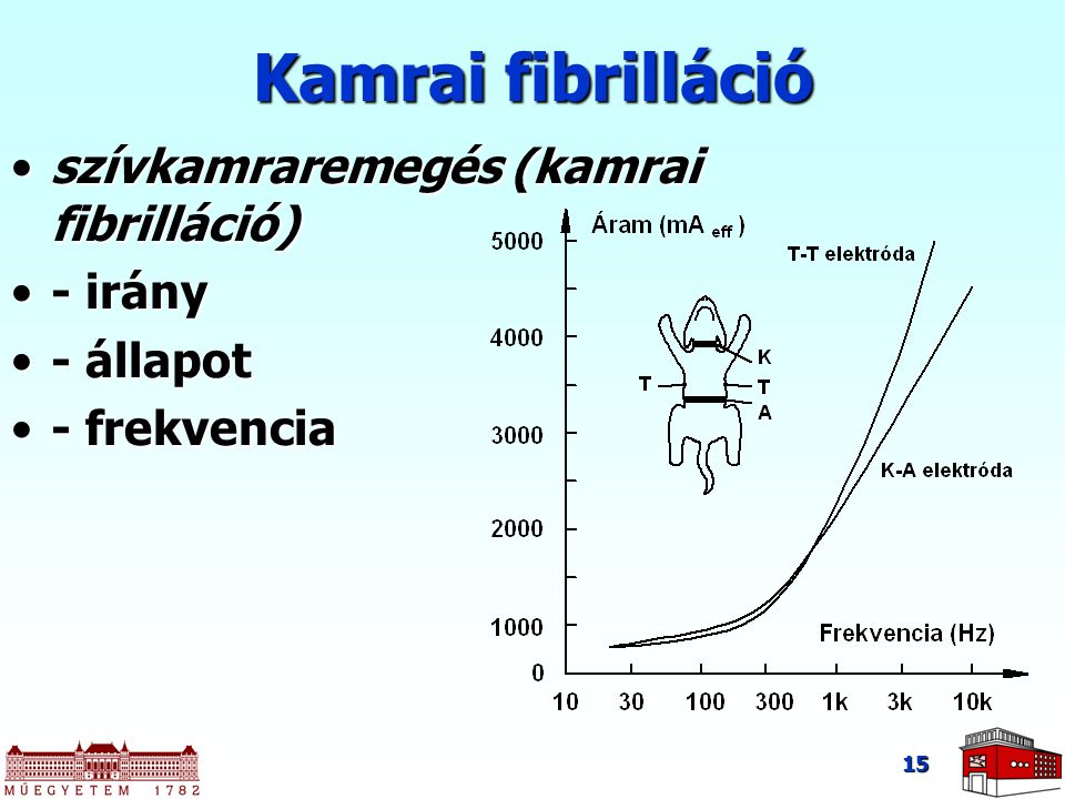 Kamrai fibrilláció szívkamraremegés (kamrai fibrilláció) - irány