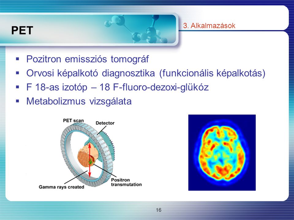 PET Pozitron emissziós tomográf
