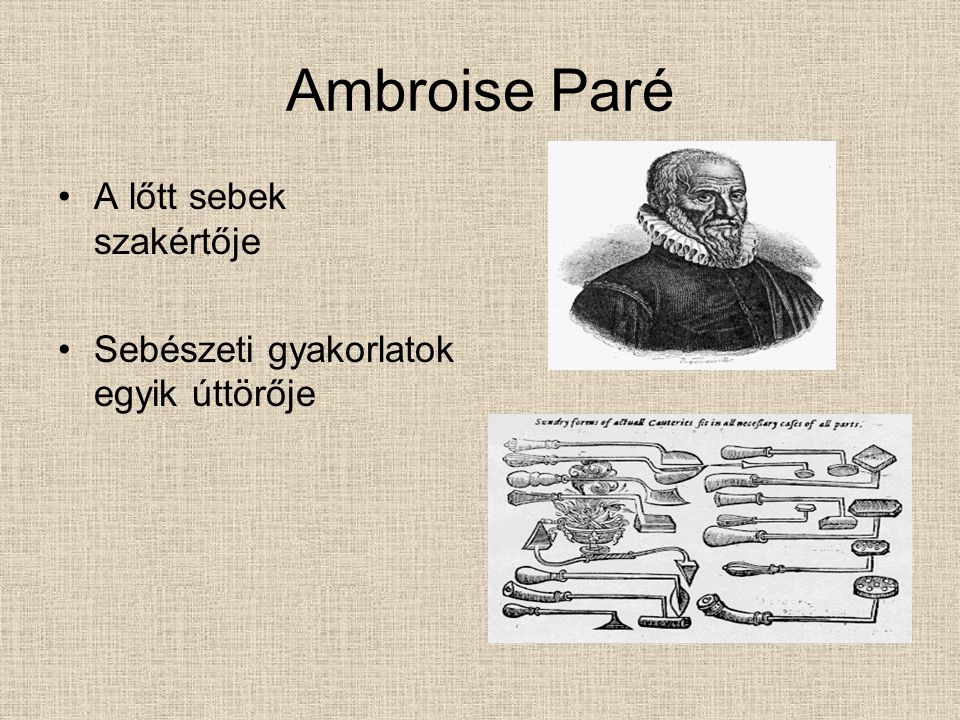 Ambroise Paré A lőtt sebek szakértője