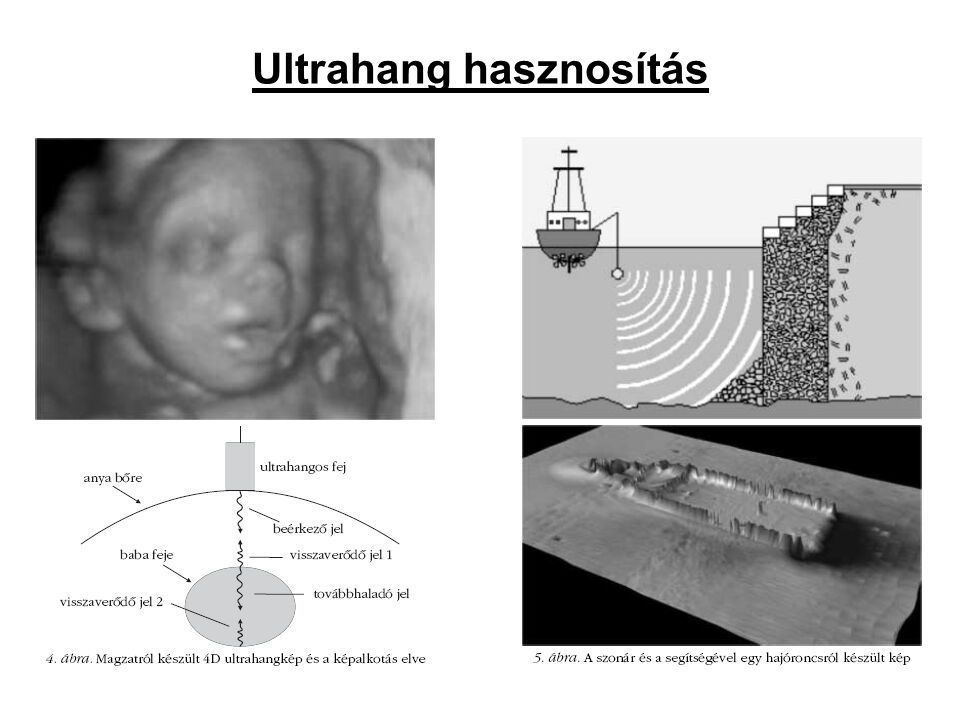 Ultrahang hasznosítás
