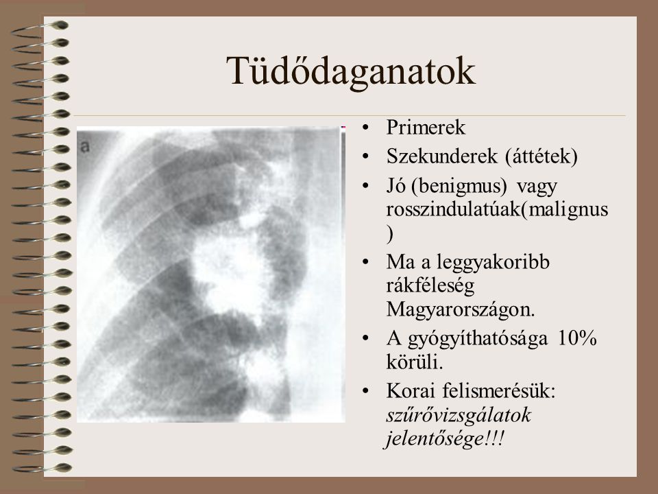 Tüdődaganatok Primerek Szekunderek (áttétek)