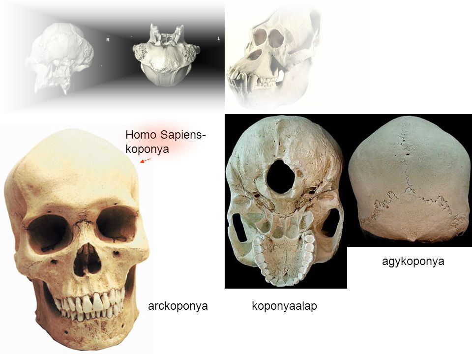 Homo Sapiens- koponya gorillakoponya agykoponya arckoponya koponyaalap