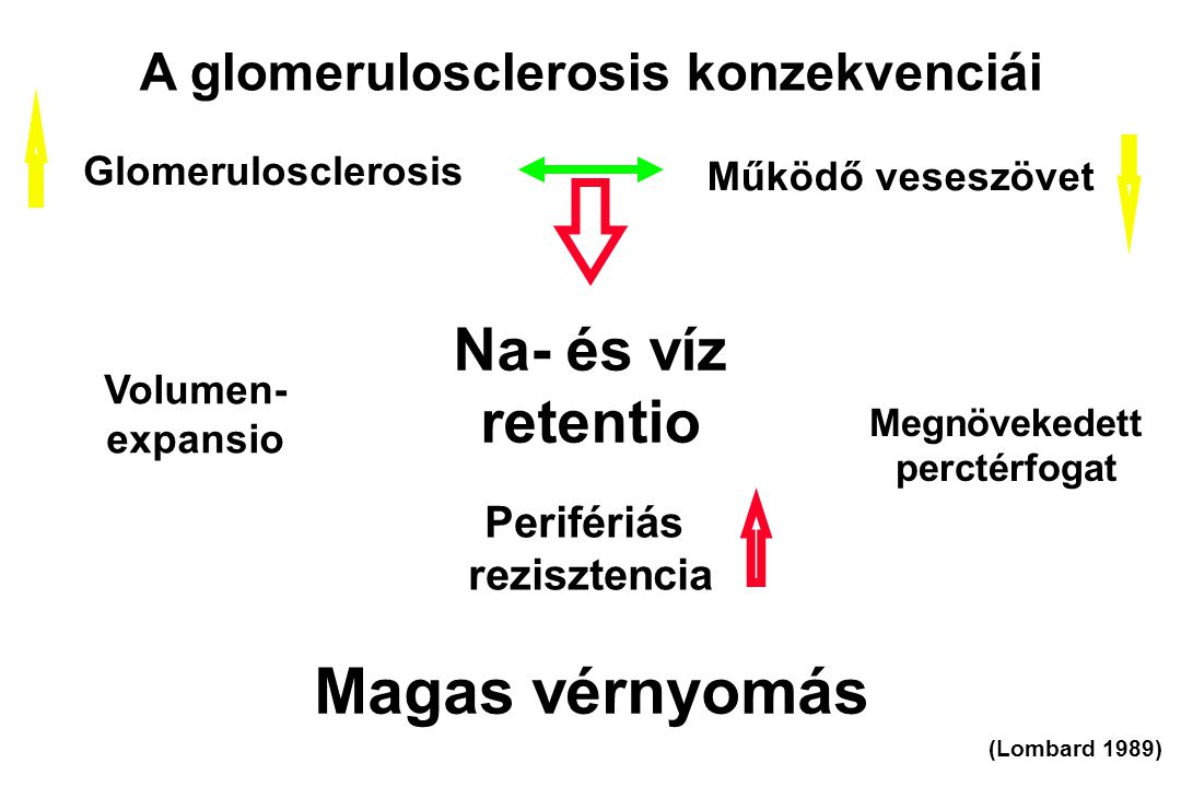 Magas vérnyomás Na- és víz retentio A glomerulosclerosis konzekvenciái