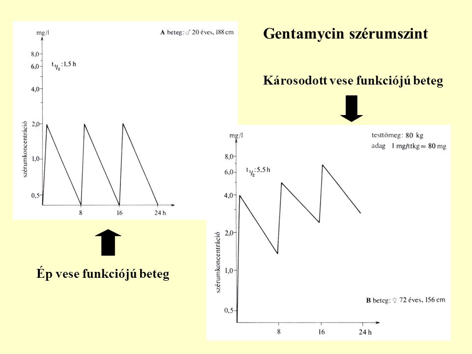 Gentamycin szérumszint