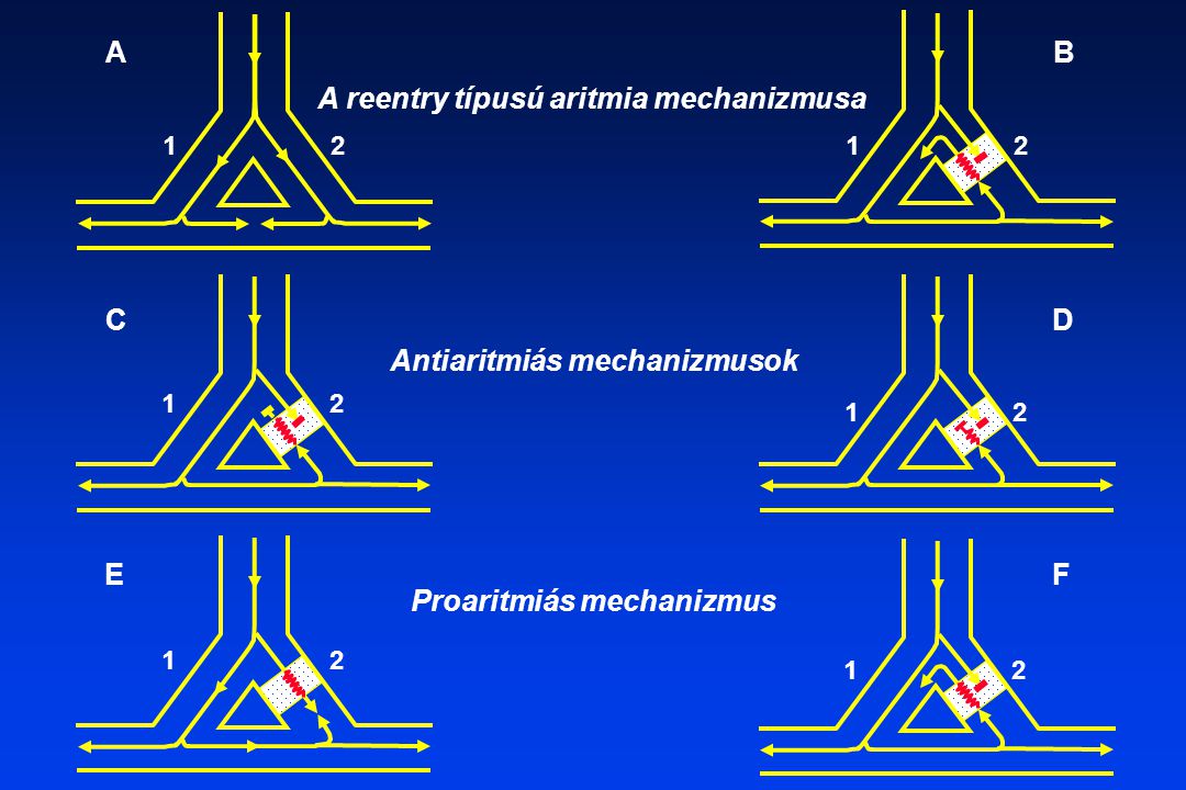 Antiaritmiás mechanizmusok Proaritmiás mechanizmus