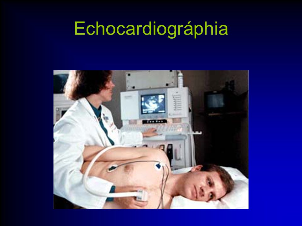 Echocardiográphia