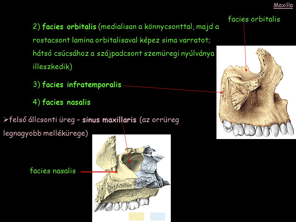 3) facies infratemporalis 4) facies nasalis