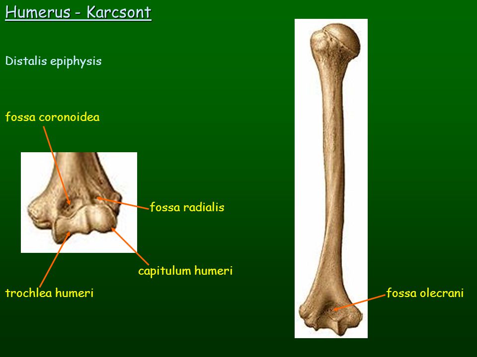 Humerus - Karcsont Distalis epiphysis fossa coronoidea fossa radialis