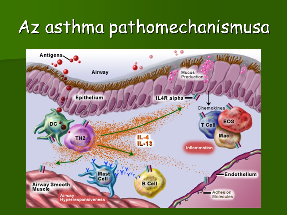 Az asthma pathomechanismusa