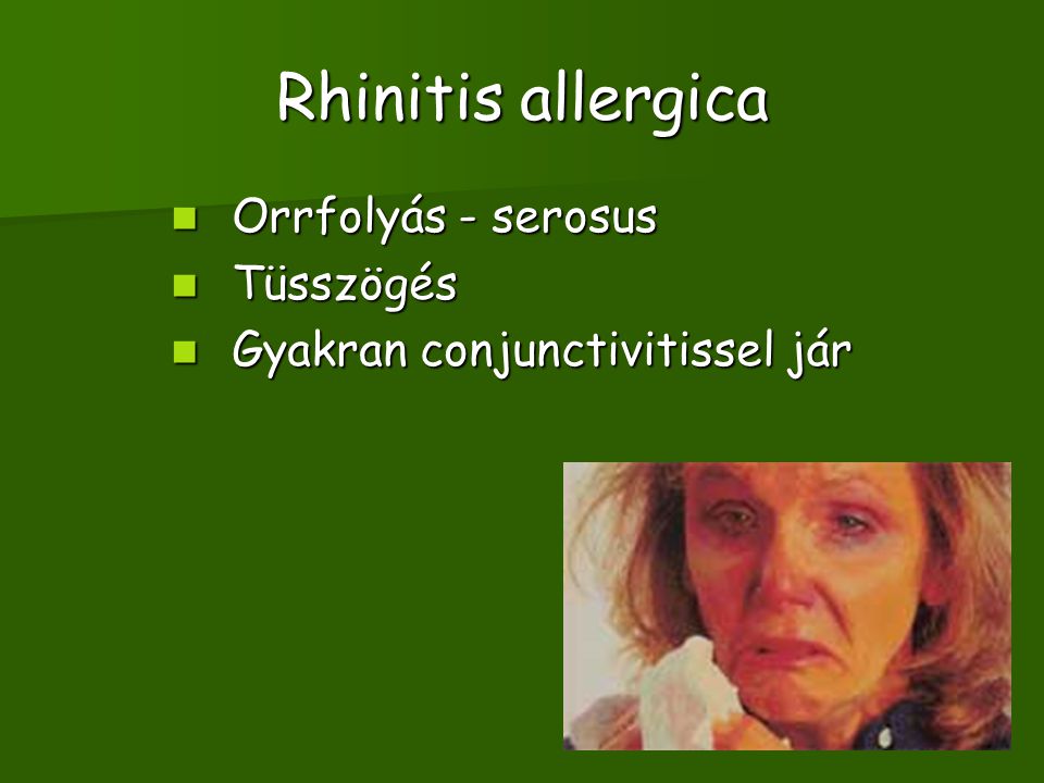 Rhinitis allergica Orrfolyás - serosus Tüsszögés