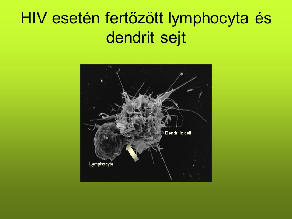 HIV esetén fertőzött lymphocyta és dendrit sejt