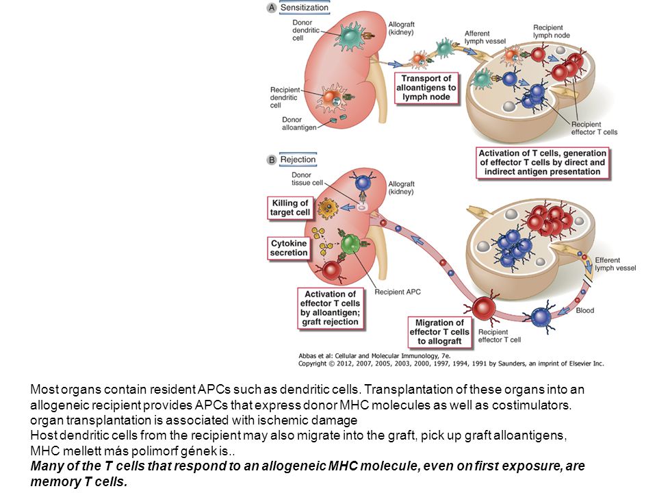 organ transplantation is associated with ischemic damage
