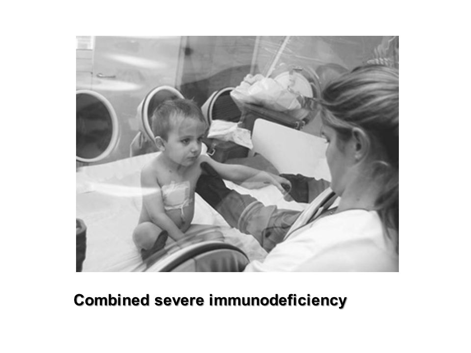 Combined severe immunodeficiency