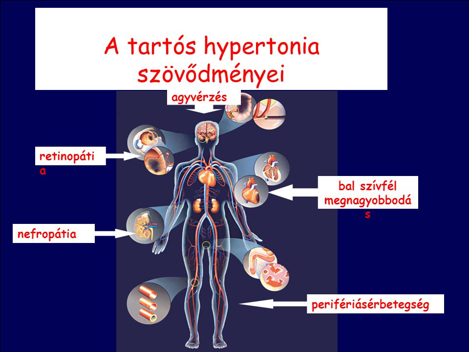 A tartós hypertonia szövődményei