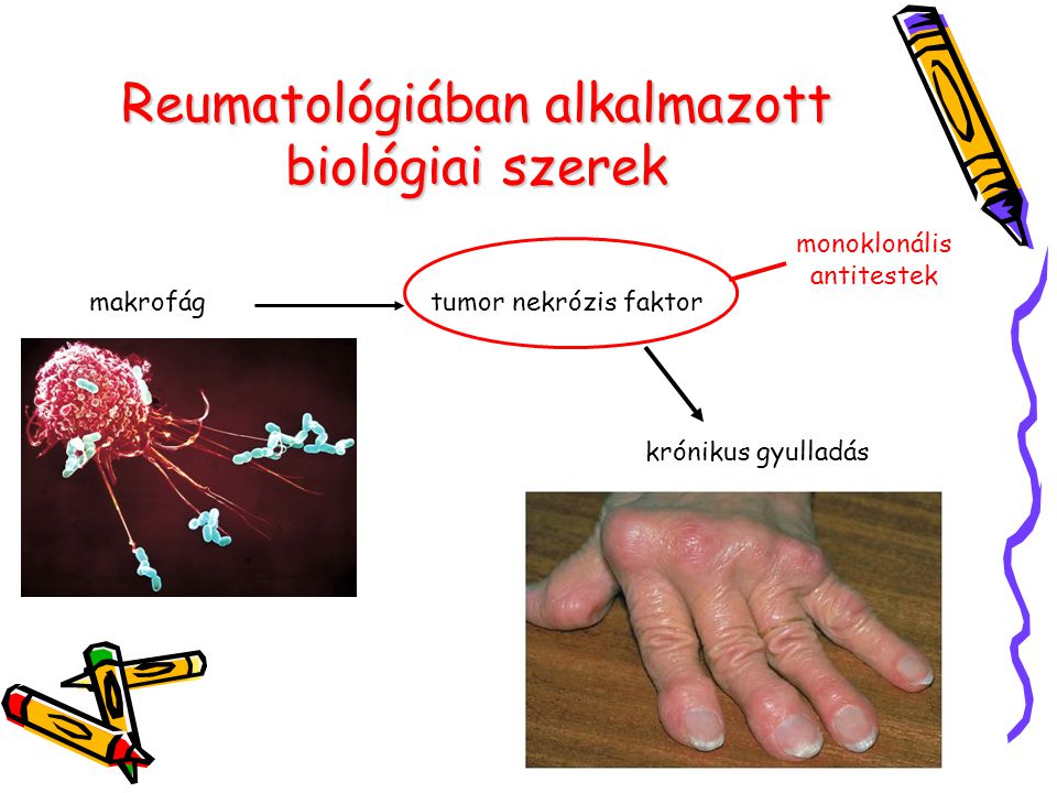 Reumatológiában alkalmazott biológiai szerek