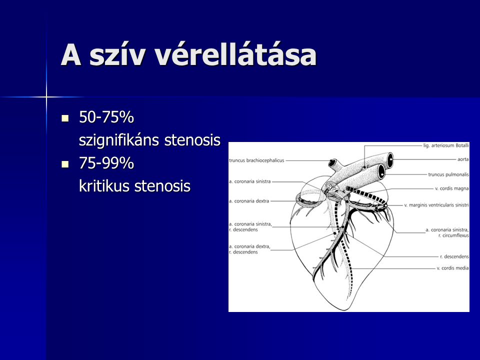 A szív vérellátása 50-75% szignifikáns stenosis 75-99%