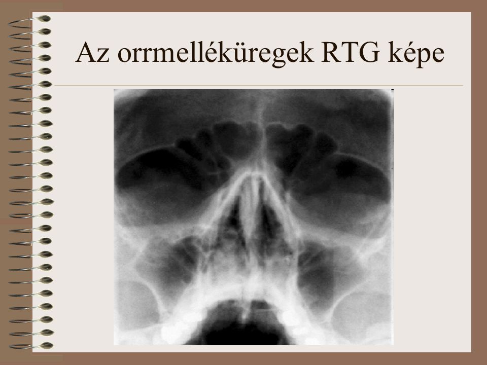 Az orrmelléküregek RTG képe