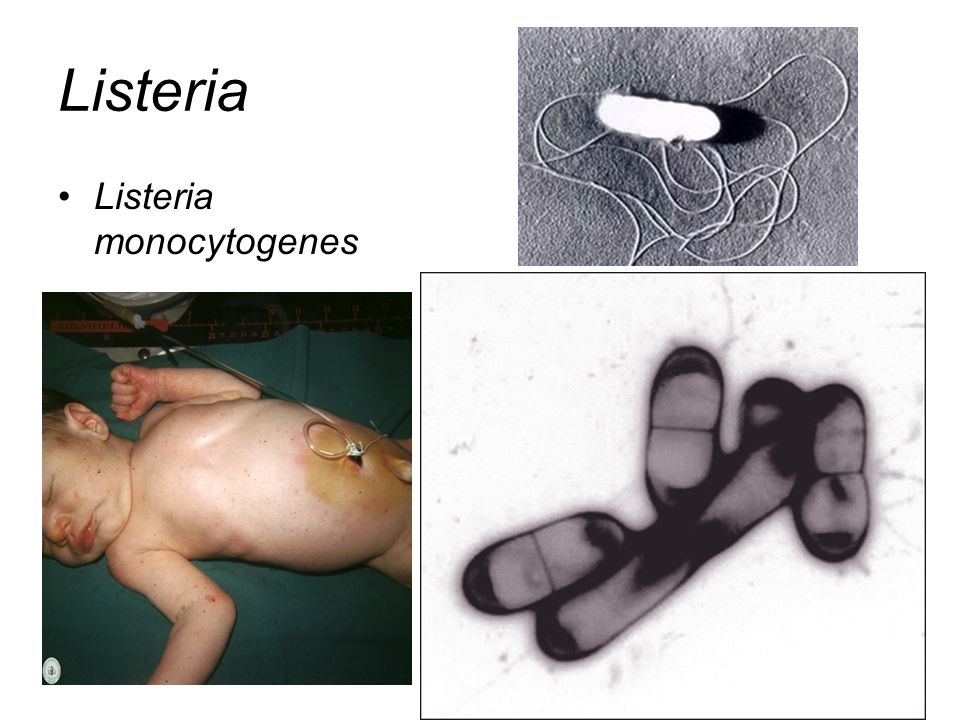 Listeria Listeria monocytogenes