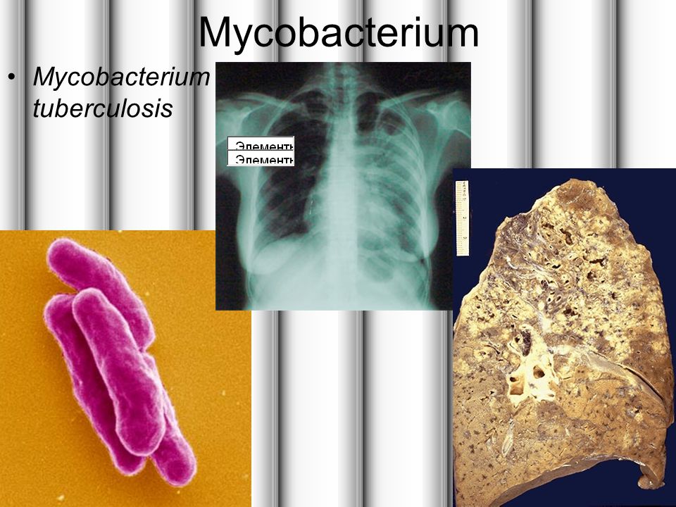 Mycobacterium Mycobacterium tuberculosis