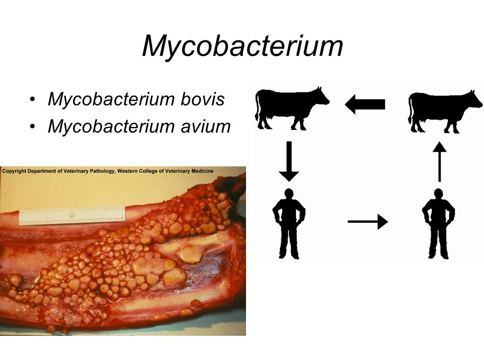 Mycobacterium Mycobacterium bovis Mycobacterium avium