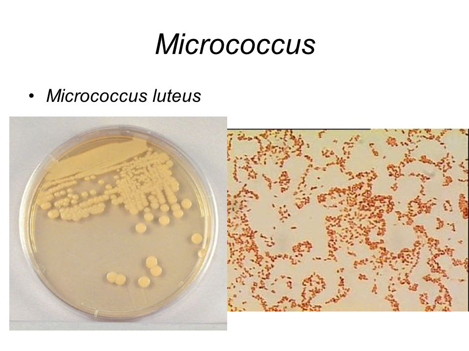 Micrococcus Micrococcus luteus