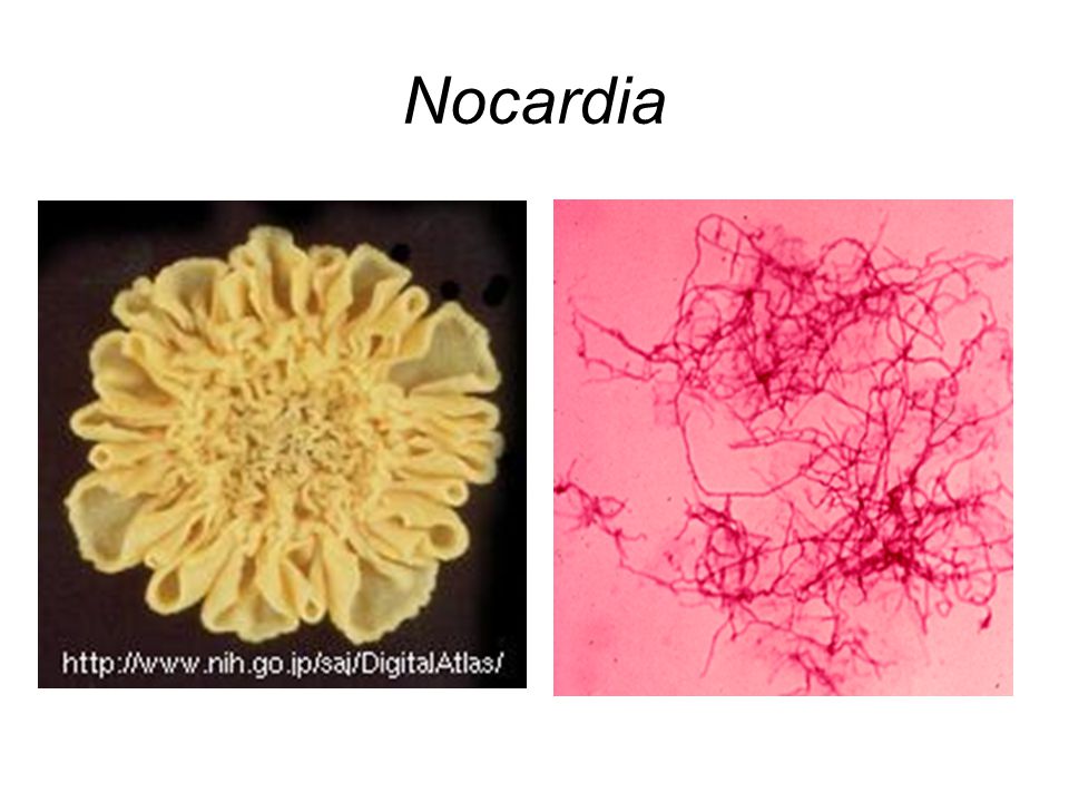 Nocardia