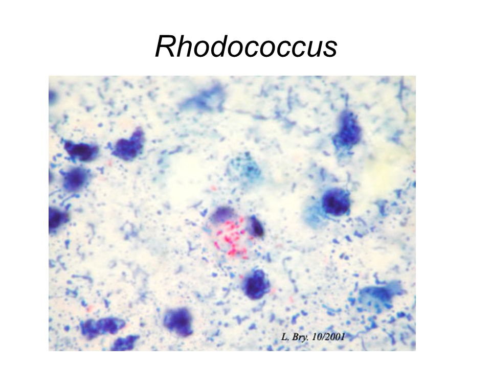 Rhodococcus