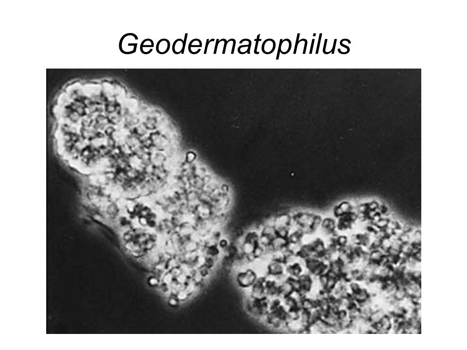 Geodermatophilus