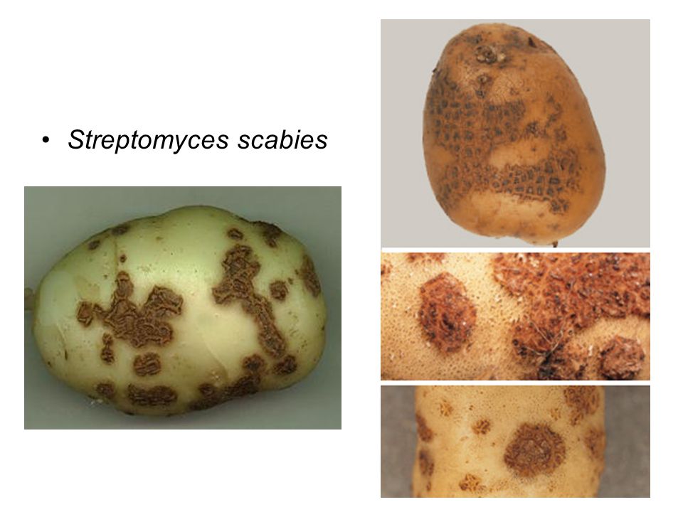 Streptomyces scabies