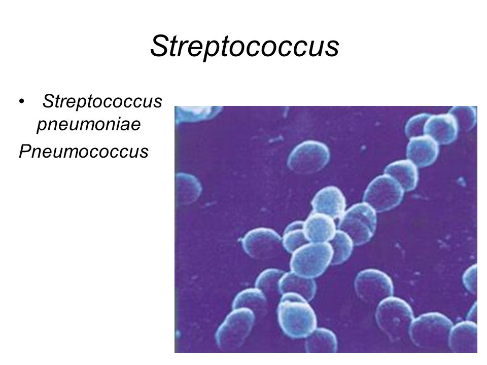 Streptococcus Streptococcus pneumoniae Pneumococcus
