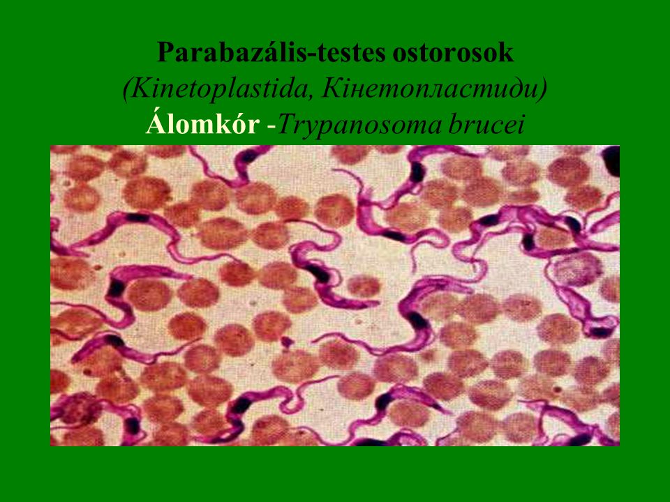 Parabazális-testes ostorosok (Kinetoplastida, Кінетопластиди) Álomkór -Trypanosoma brucei