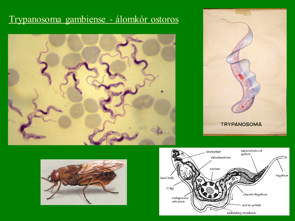 Trypanosoma gambiense - álomkór ostoros