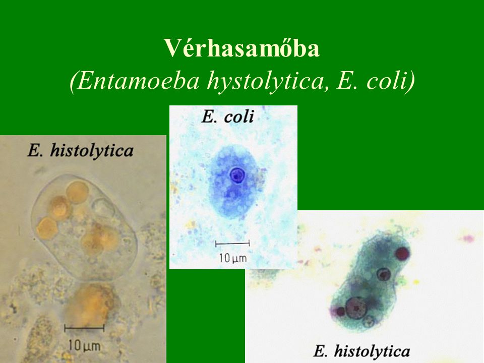Vérhasamőba (Entamoeba hystolytica, E. coli)