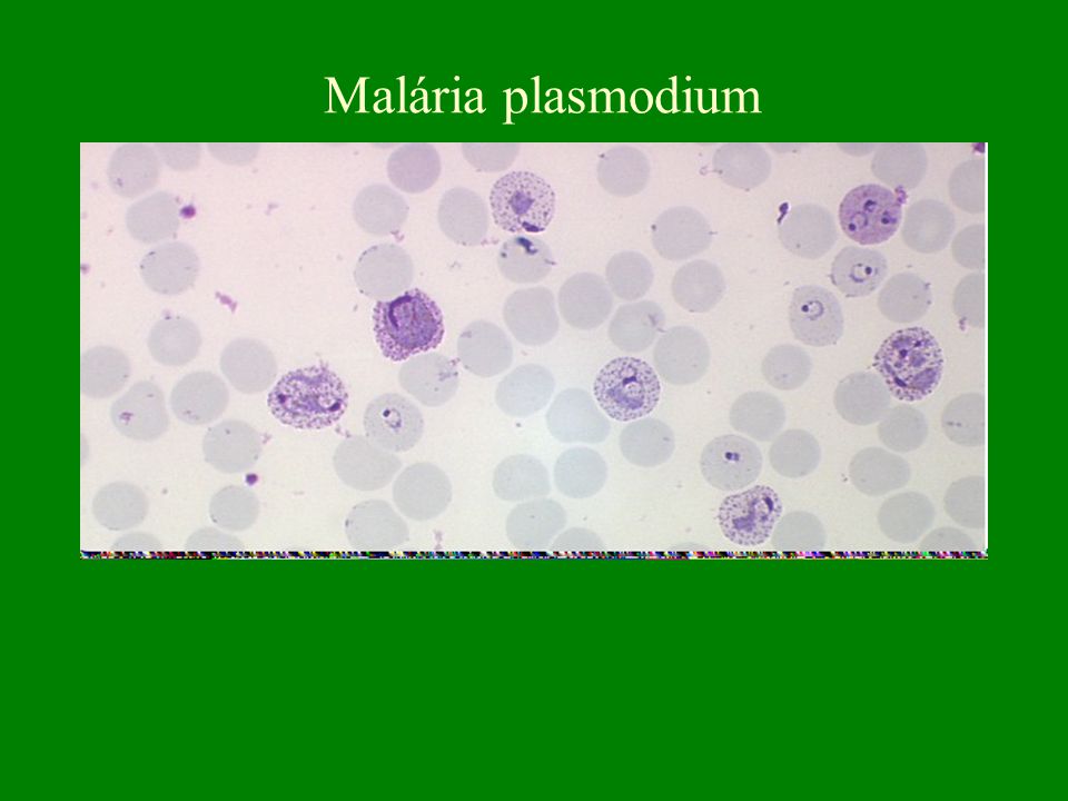 Malária plasmodium